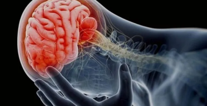 Tu cuerpo te puede avisar un mes antes si sufrirás un derrame cerebral