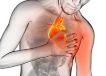 Nuestro cuerpo podría enviarnos señales que vamos a tener un infarto un mes antes.