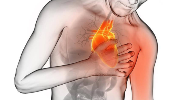 Nuestro cuerpo podría enviarnos señales que vamos a tener un infarto un mes antes.